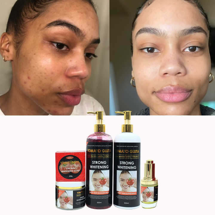 glutathion set factory Oem Private Label Skincare Kit Toamto Gluta High Quality Face Skin Care Vegan Organic Skincare Manufacturer fixpp and is produced exclusively Cápsula De Peptide Bpc-157, Size:Retatrutide 50mg