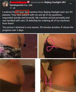 Pelangsing tubuh 5d pembakar lemak <span class=keywords><strong>lllt</strong></span> <span class=keywords><strong>laser</strong></span> pembakar lemak keras 650nm tingkat rendah terapi cahaya 210mw mesin injeksi penurun berat badan - Product Image 6