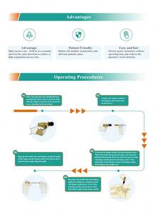 Elektrisch Beenmerg Biopsiesysteem Medisch Botboor Aspiratienaalden Te Koop Chirurgische Apparatuur - Product Image 4