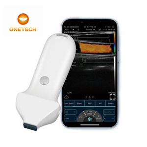 Ecógrafo Portátil C37E CE EFDA 18-24MH para Cirujanos, Sistema de Imágenes Ultrasónicas Digitales para Ver la Estructura de la Piel del Rostro - Product Image 1