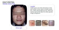 Professional Intelligent AI Scanner Face Mirror Device Dermatoscope Skin Analysis Machine Facial Skin Analyzer Machine