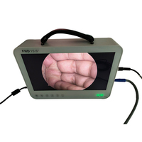 Équipement d'endoscopie chirurgicale portable 4 en 1 Unité de caméra endoscopique Full HD de 15.6 pouces pour laparoscopie