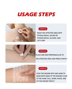 Ce chứng nhận steri-dải vết thương đóng cửa hệ thống da kéo dài và an toàn vết thương Hệ thống đóng cửa - Product Image 5