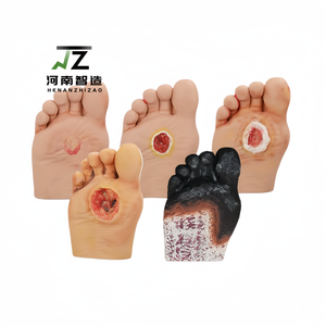 Modèle de pied diabétique en silicone de haute qualité avec ulcères purulents pour l'enseignement infirmier - Product Image 1