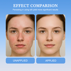 Nhãn hiệu riêng dưỡng ẩm mặt huyết thanh nhẹ nhàng chống lão hóa mất dần đốm đen mụn cứu trợ nhẹ nhàng chăm sóc da huyết thanh - Product Image 6