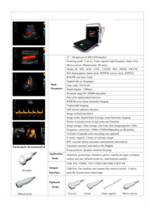 Sistema de Ultrasonido Profesional HD 3D 4D de 15 Pulgadas con Función Doppler PW CW para Aplicaciones de Cardiología - Product Image 4