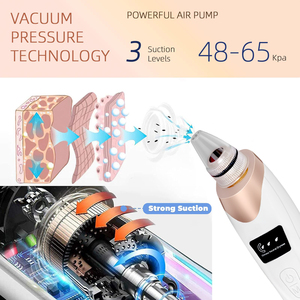 Aspirateur à points noirs rechargeable, nettoyeur de pores professionnel pour le <span class=keywords><strong>visage</strong></span>, équipement de <span class=keywords><strong>soin</strong></span> de la peau - Product Image 4