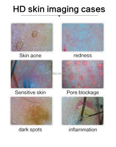 صالون تجميل متعدد الوظائف صالون تجميل مخصص لتجديد الشعر محلل فروة الرأس - Product Image 3