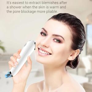 4 Modes 5 in 1 Vacuum <b>Blackhead</b> Dark Spot Remover Facial Hot and Cold Compress Device Waterproof ABS - Product Image 4