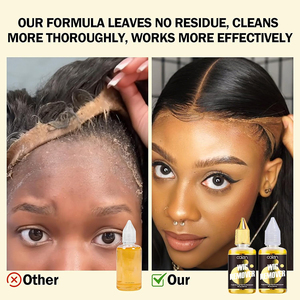 OALEN OEM Dissolvant pour ruban adhésif de perruque Lace Front, Dissolvant de <span class=keywords><strong>colle</strong></span> pour perruque Lace 30ml, Dissolvant de perruque Lace - Product Image 4