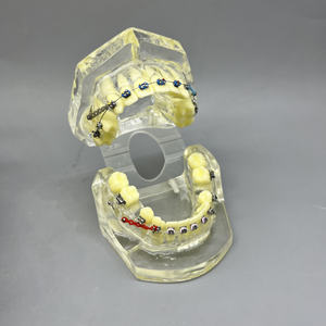 โมเดลการสาธิตการจัดฟันพร้อมสายรัดและแถบยางสำหรับคลินิกทันตกรรมและการสื่อสารกับผู้ป่วย - Product Image 5