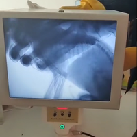 Prix de la machine à rayons X vétérinaire Portable/Machine RX humaine vétérinaire numérique portable pour la clinique vétérinaire pour animaux de compagnie