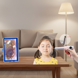 Limpiador de Oídos Inteligente con Endoscopio HD Eléctrico, Cuchara Digital para Remover Cera de Oídos con Microscopio, Limpiador Visual de Oídos - Product Image 1