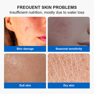 OEM <span class=keywords><strong>crema</strong></span> viso acido ialuronico 72H idratante Multi-molecolare HA profonda idratazione Anti-rughe <span class=keywords><strong>rimpolpante</strong></span> per tutti i GMP Aqua Squalane - Product Image 5