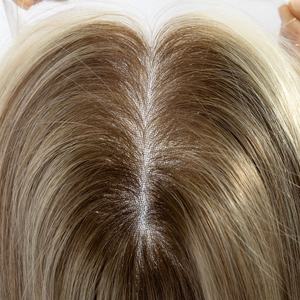 Premier Hair Virgin European Remy Hair Toupee Premium Remy Human Hair Toppers para mujeres Luxury HD Lace Toppers Mini pelucas proveedor - Product Image 4