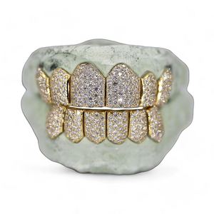 Grillz 6 sur 6 en Moissanite VVS, personnalisés style Hip Hop, plaqués or, en argent 925, sertis de diamants, pour hommes et femmes - Product Image 1