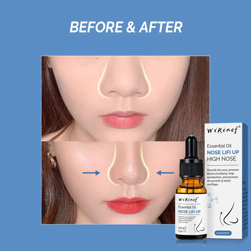 Nose Up Heighten Rhinoplasty Oil Collagen Firming Moisturizing Nasal Bone Remodeling Pure Natural Nose Care Thin Smaller Nose