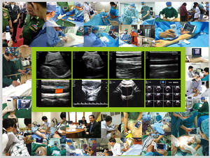 Mesin <span class=keywords><strong>Ultrasound</strong></span> Nirkabel Portabel Multi-Sistem SonoStar - Product Image 6