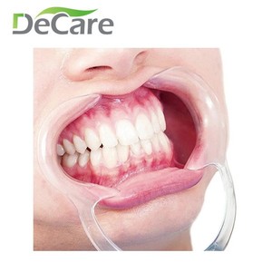 Écarteur buccal jetable en plastique type C DeCare, grande taille, pour orthodontie et thérapie orale - Product Image 5