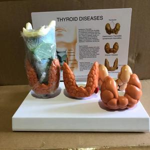 Modelo Anatómico de PVC de la Tiroides Humana para Patología y Enfermedades, Modelo de Órgano para Pruebas de Medicamentos, para Aprendizaje y Entrenamiento en Ciencias Médicas - Product Image 2