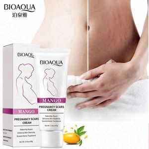 妊娠纹霜工厂 OEM ODM 芒果身体产后恢复去除 - Product Image 1