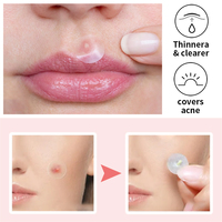 Patchs hydrocolloïdes à base d'eau pour l'acné, marque privée, favorisent la réparation de l'acné et réduisent les rougeurs, patchs invisibles pour les boutons du visage