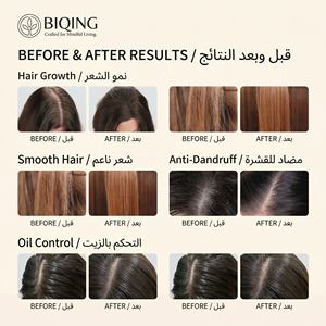 Champú y Acondicionador de Cebolla Roja y Semilla Negra Anticaída de Marca Blanca para el Crecimiento del Cabello - Product Image 5