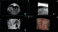 EURVET Vetease 3 Scanner CT vétérinaire (CBCT) avec construction en acier inoxydable certifié CE pour l'imagerie animale en milieu hospitalier