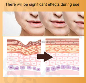 Crème anti-âge OTVENA, formule à base de plantes cliniquement testée, effet raffermissant instantané, réduit les rides et les taches de vieillesse, étiquette privée OEM/ODM - Product Image 5