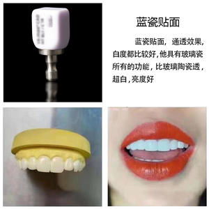 Facettes dentaires en porcelaine privée pour couvrir les dents, porcelaine bleue, porcelaine ambrée pour la formation des étudiants, enseignement des facettes - Product Image 3