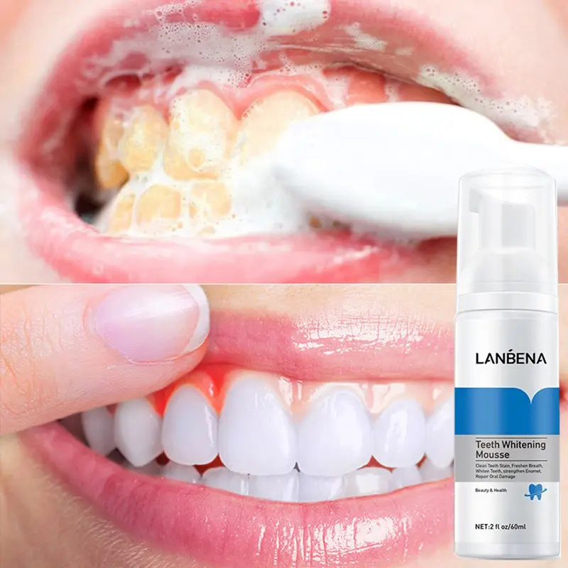 LANBENA — Mousse pour le blanchiment des dents, nettoyant pour les dents blanches, hygiène buccale, dentifrice, élimine les taches, produit tendance