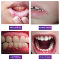 Cotons-tiges liquides antibactériens oraux, maux de dents et analgésiques buccaux induits par la chaleur Patchs nasaux et pour le corps