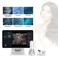 Analyseur de Cheveux et Cuir Chevelu 3-en-1 Portable à Lumière UV 2026 – Détecteur de Follicules Capillaires en Plastique Écologique de Haute Qualité