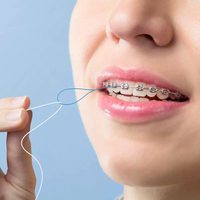 Enfile-fil dentaire orthodontique Luca pour espaces étroits, appareils dentaires, implants, larges espaces entre les dents, en nylon, Too Care
