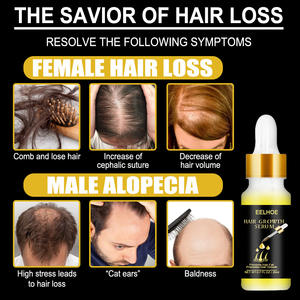 Hot Sale Natural Herbal Anti <b>Hair</b> Loss Repairing <b>Hair</b> Growth Liquid <b>Hair</b> Nutrient Growth Oil - Product Image 6