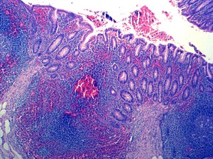医学HenanYulinプロの人間の病理学スライド人間の炎症について - Product Image 3