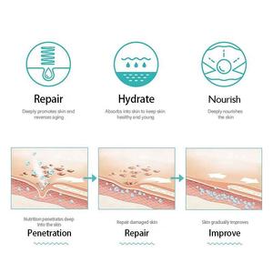 Oem מגביר ייצור קולגן שתן תפוח תאי גזע חומצה היאלורונית סרום פנים - Product Image 6