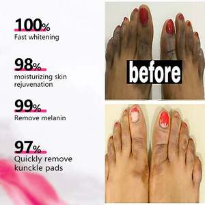 โลชั่นบำรุงผิว ลดรอยดำด้าน ข้อศอก หัวเข่า สำหรับผิวชาวแอฟริกัน ของแท้ ขายส่งจากโรงงาน - Product Image 3