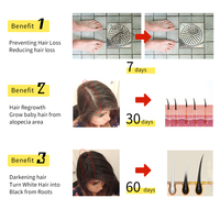 Propre Logo Solution de croissance rapide des cheveux, sérum à l'huile stimulant pour cheveux épais pour hommes, shampoing Anti-chute au gingembre