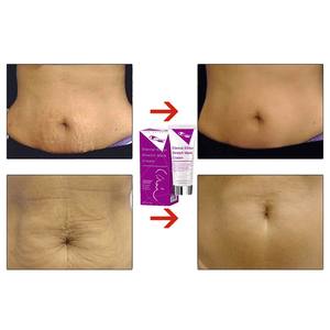 Crème Réparatrice Cutanée au Beurre de Karité de Haute Qualité, Infusée de Perles, Collagène et Aloe Vera – Puissant Éliminateur de Vergetures et Cicatrices - Product Image 2