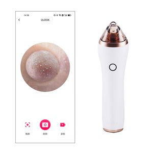 Venta caliente removedor de espinillas Limpieza de poros de mano para piel mixta grasa con pantalla de cámara para limpiar el cuidado del acné - Product Image 6