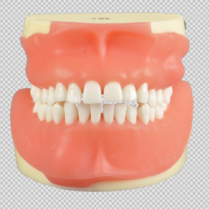 Modèle de typodont pour la formation en suture dentaire, pour la chirurgie buccale, extraction des dents impatiente, incision gingivale - Product Image 1