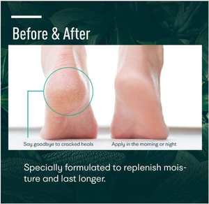 <span class=keywords><strong>Crème</strong></span> pour les pieds à base de plantes, <span class=keywords><strong>crème</strong></span> <span class=keywords><strong>antifongique</strong></span> et antimicrobienne pour les pieds <span class=keywords><strong>d</strong></span>'athlètes - <span class=keywords><strong>D</strong></span>ésodorisant naturel pour les pieds pour contrôler les odeurs - Product Image 5