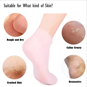 Chaussettes hydratantes pour pédicure pour femmes, pour les pieds secs et gercés, adoucissantes, rugueuses, élastiques, antidérapantes, protection des pieds, soin de la peau des pieds en silicone - Product Image 3