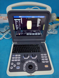 Mesin USG Doppler Warna Portabel MSLCU28, Pemindai USG Digital <span class=keywords><strong>Laptop</strong></span> - Product Image 5