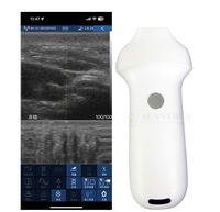 Sonde d'échographie portable sans fil 20 Hz à 192 éléments pour soins esthétiques de la peau