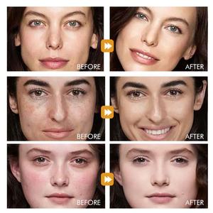 Sérum AHA BHA pour le visage, éclaircissant, anti-cicatrices, anti-âge, soin de la peau naturel et biologique - Product Image 5