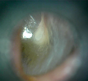 ML-402 wifi Numérique <span class=keywords><strong>microscope</strong></span> prenant en charge IOS/<span class=keywords><strong>Android</strong></span>/WIndows avec vidéo HD ménage wifi d'otoscope D'endoscope sans fil - Product Image 6