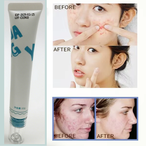 Soin de la peau en marque privée, gel réparateur anti-acné, élimination des boutons, soin de la peau à base d'herbes à l'arbre à thé, traitement de l'acné pour tous les types de peau - Product Image 6