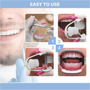 Écarteur de joue dentaire 3D élastique pratique, écarteur buccal intra-oral, ouvre-bouche pour accessoires dentaires, 2 pièces (S) - Product Image 4